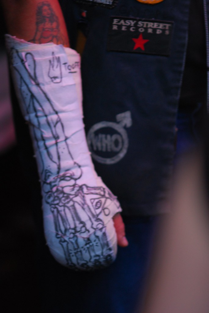 685x1023 Best Cast Drawing Ever Brian Yeung - Leg Cast Drawing