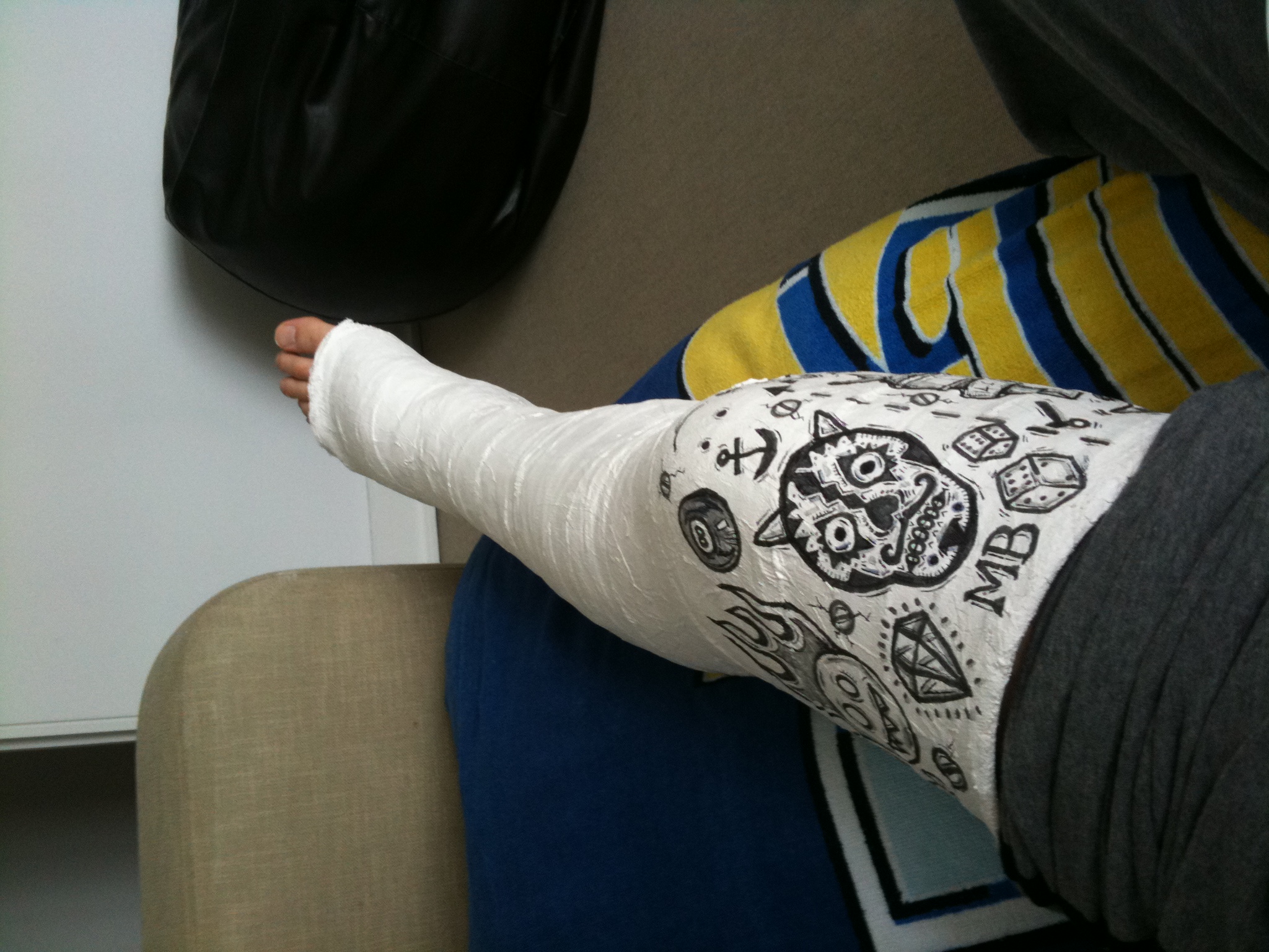 2048x1536 Tendon My - Leg Cast Drawing