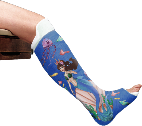 476x420  - Leg Cast Drawing