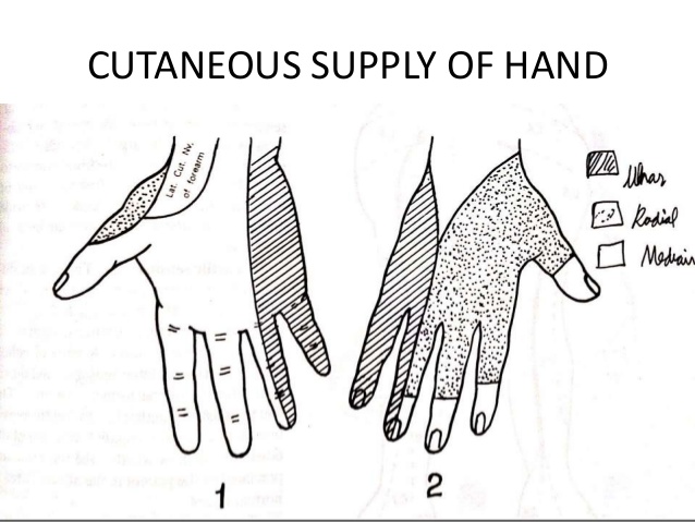 638x479 leprosy tests - Leprosy Drawing
