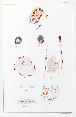 310x476 the leprosy bacillus, circa the scientist - Leprosy Drawing