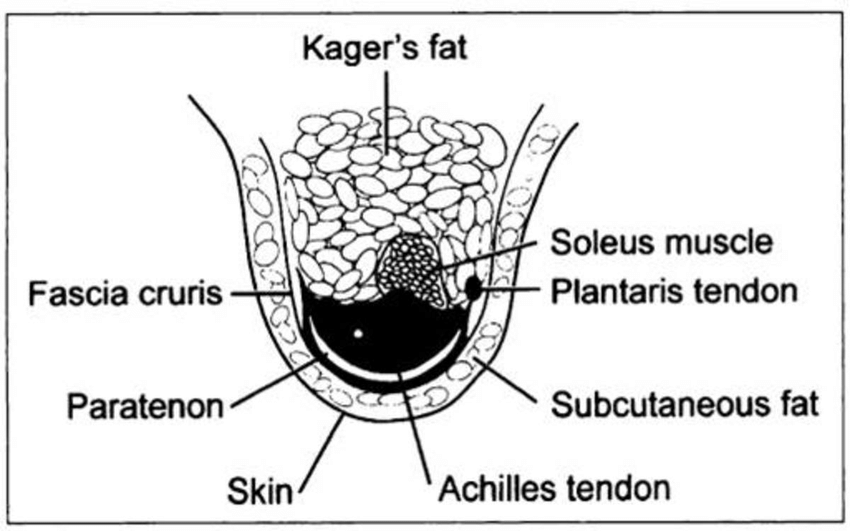 850x531 Cross Sectional Line Drawing Of The Lower Leg Showing - Line Drawing Of Cross