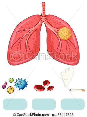 Lung Cancer Drawing at PaintingValley.com | Explore collection of Lung