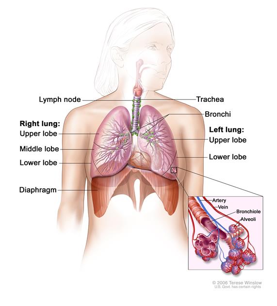 571x631 rare cancers australia - Lung Cancer Drawing