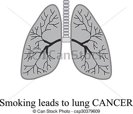 450x387 smoking leads to lung cancer vector illustration on vector - Lung Cancer Drawing