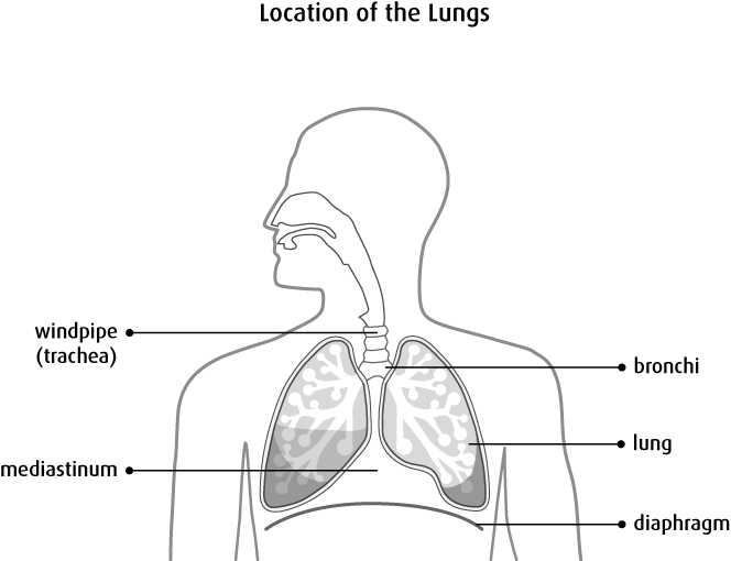 664x510 what is lung cancer - Lung Cancer Drawing