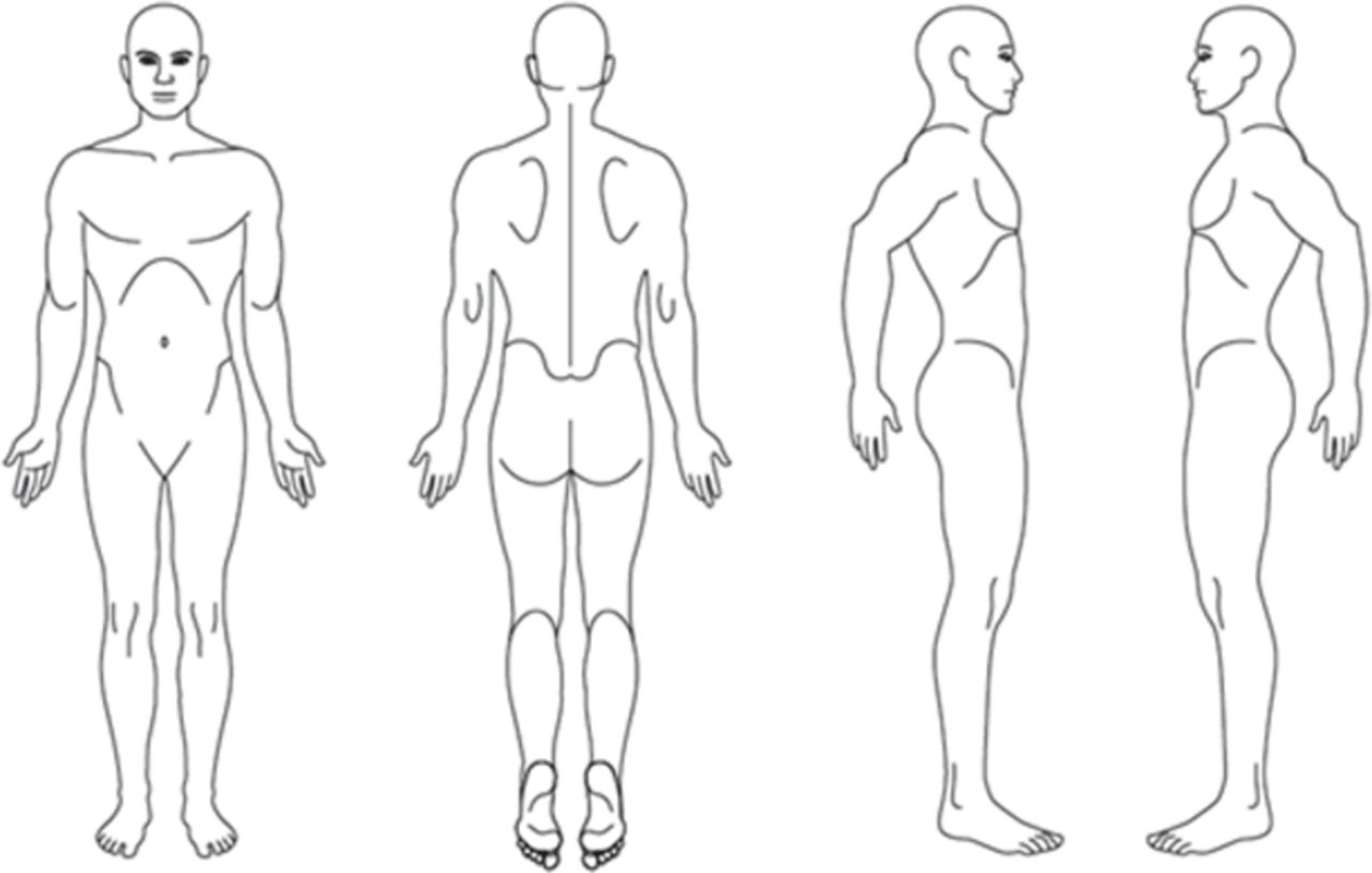 1280x815 patient pain drawing is a valuable instrument in assessing - Male Figure Outline Drawing