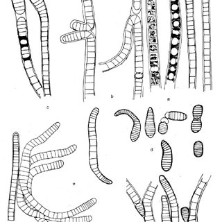 320x320 drawing of brasilonema tolantongensis - Mature Drawing