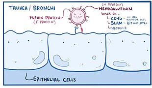 310x179 measles - Measles Drawing