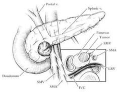 236x188 huge collection of 'medical body drawing' download more than - Medical Body Drawing
