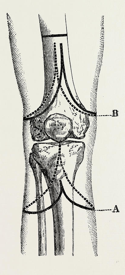 412x900 stephen smiths, medical equipment, surgical instrument drawing - Medical Equipment Drawing