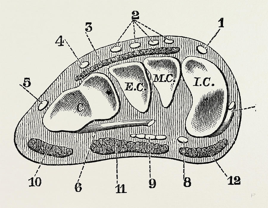 900x698 transverse section, medical equipment, surgical instrument - Medical Equipment Drawing