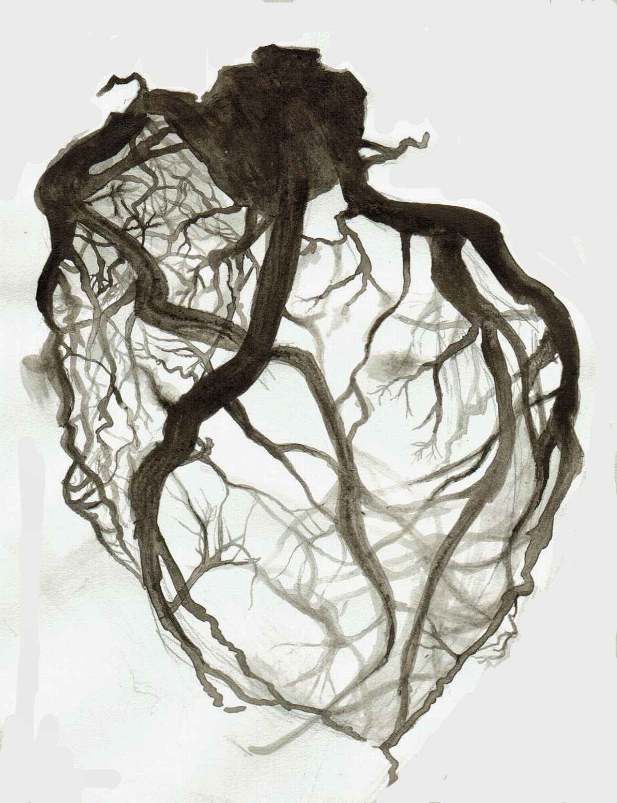 1231x1600 correio da alyssa bean cardiac cath lab! art - Medical Heart Drawing