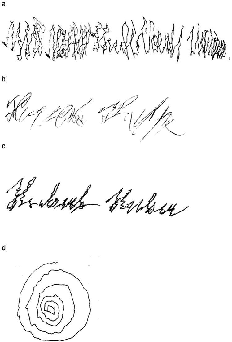 749x1103 Patient's Writing And Drawing Under Medication Of Bupranolol Mg - Medication Drawing