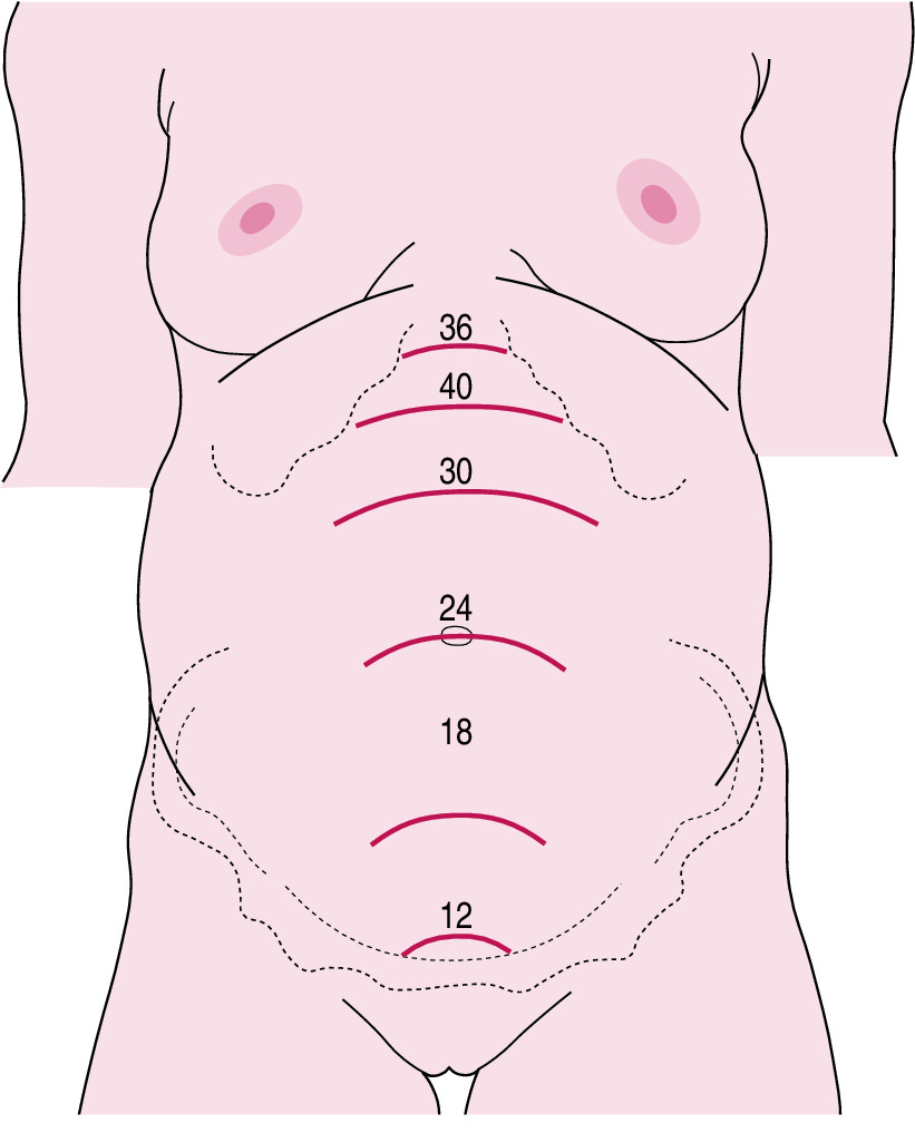 821x1017 The Practising Midwife - Midwife Drawing