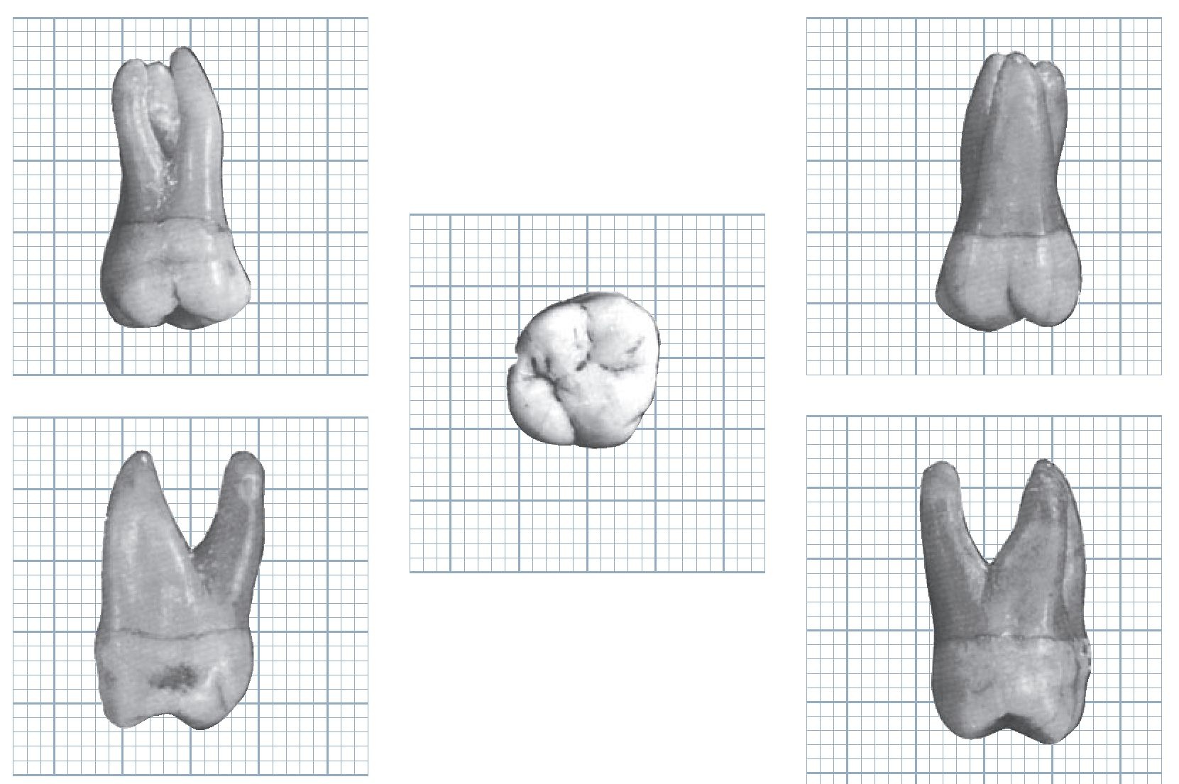 Первый моляр верхней челюсти. Maxillary second molar. Maxillary first molar. Molar Dent Anatomic.