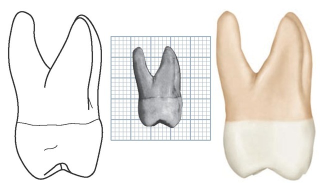 640x366 the permanent maxillary molars - Molar Drawing