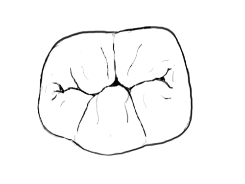 500x375 info about cavities - Molar Drawing