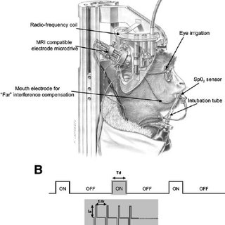 320x320 combined electrical microstimulation and mri in primates - Mri Drawing