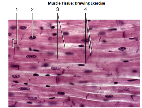 464x353 solved muscle tissue drawing exercise - Muscle Tissue Drawing