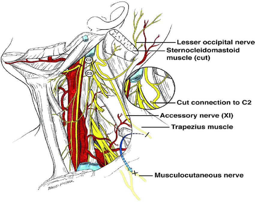 850x673 schematic drawing of the concept of detethering the accessory - Nerve Drawing