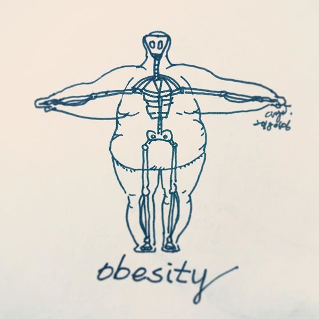 640x640 obesity - Obesity Drawing