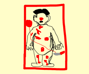 300x250 Operation, The Board Game Drawing - Operation Drawing