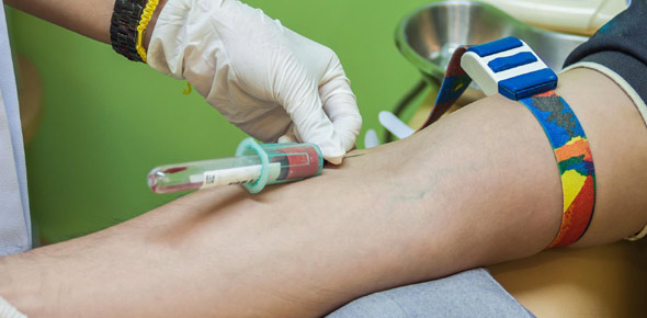 590x290 order of draw phlebotomy chapter quiz - Order Of Drawing