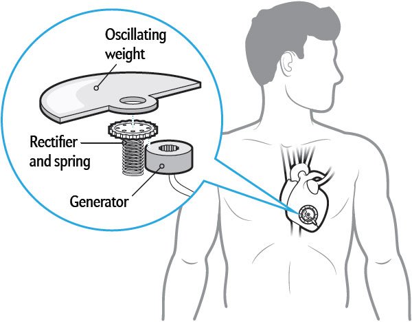 600x468 Pacemaker Powered - Pacemaker Drawing