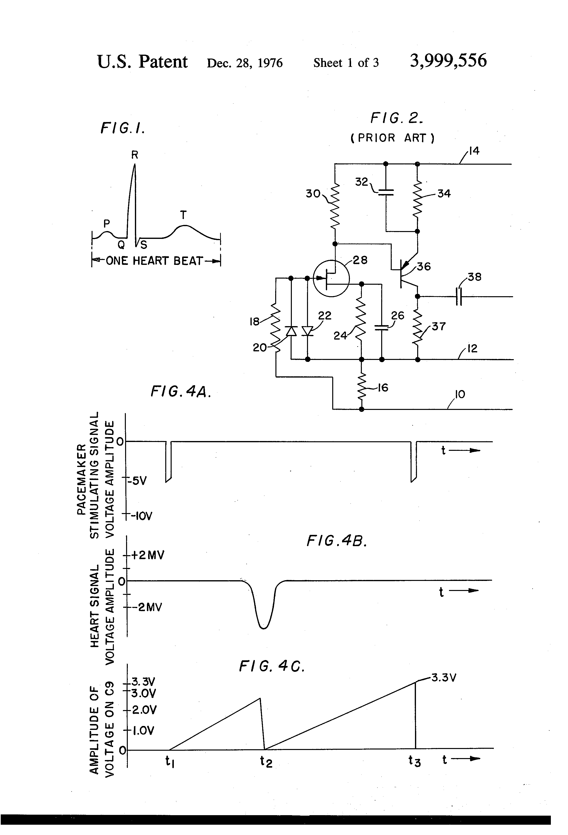 2320x3408 Patent - Pacemaker Drawing