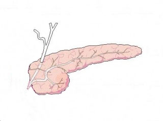 320x238 pancreas research group department of clinical medicine - Pancreas Drawing
