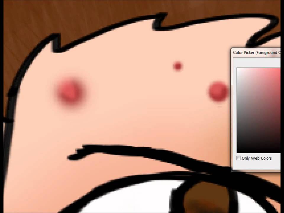 960x720 how to draw pimples - Pimple Drawing