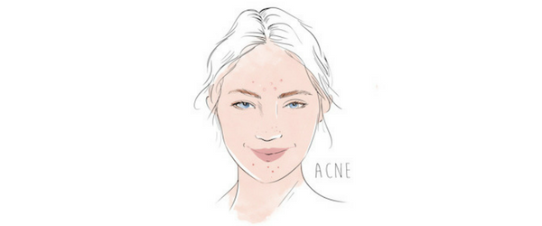 600x250 what are those tiny bumps on your face dermstore blog - Pimple Drawing