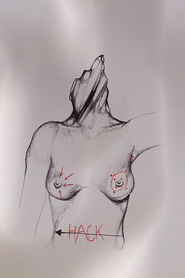 599x900 Plastic Surgery Drawing - Plastic Drawings