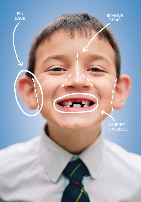 490x701 Plastic Surgery Where Do Parents Draw The Line - Plastic Surgery Drawing