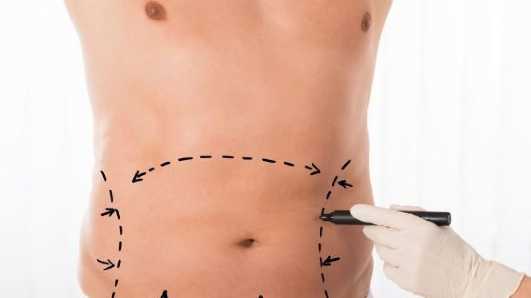 1862x1048 The Most Popular Plastic Surgeries For Men Fox News - Plastic Surgery Drawing