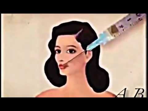 480x360 Copy Of Plastic Surgery Animation - Plastic Surgery Drawing