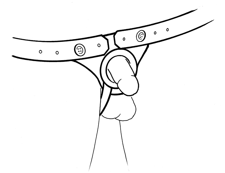 737x566 Imagesdevices For Penile Retraction - Pressure Drawing