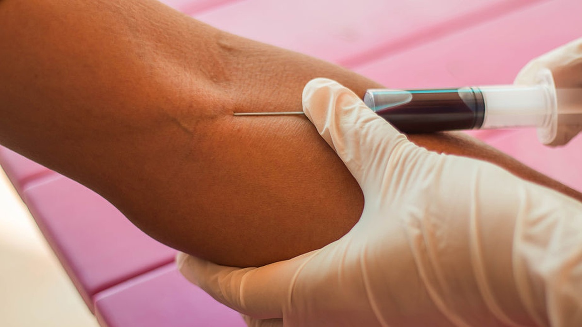 1199x674 How To Draw Blood Like A Pro - Procedure Drawing