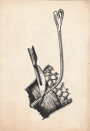 300x437 Vintage Medical Procedure Drawing - Procedure Drawing