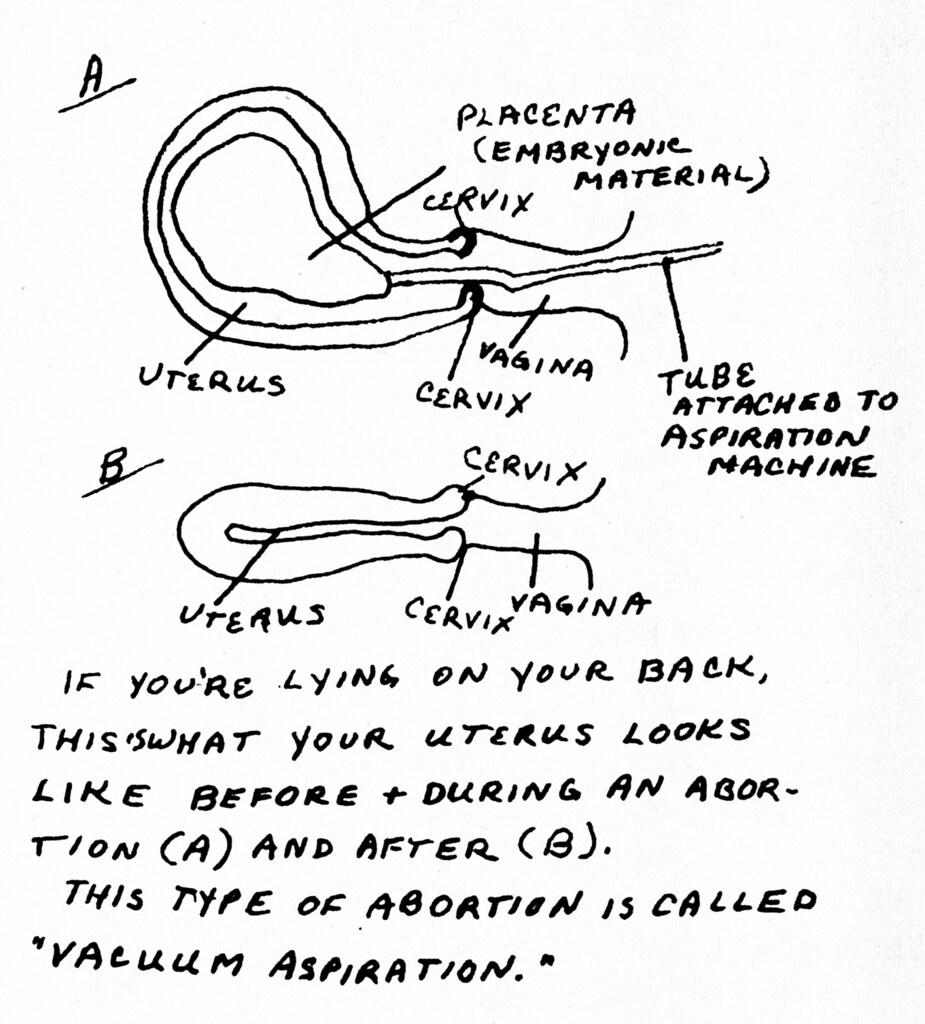 925x1024 Drawing Of Procedure A Hand - Procedure Drawing