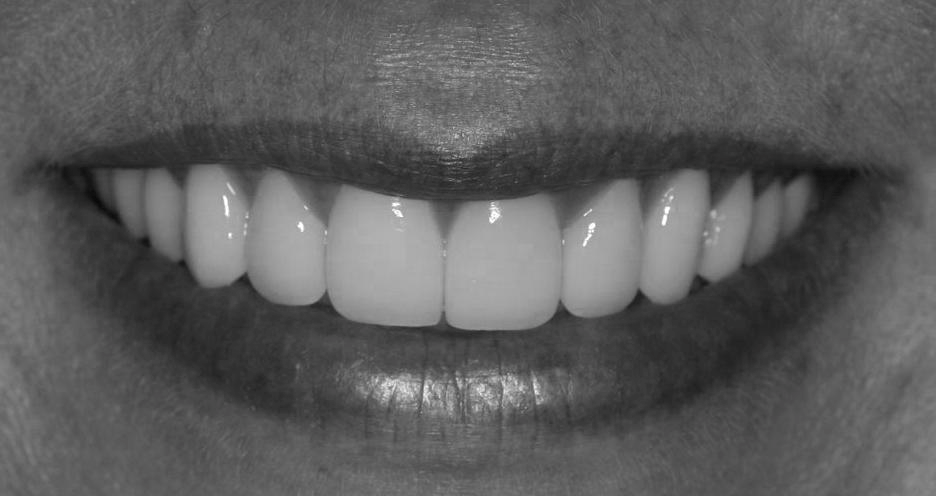 936x496 How To Draw Realistic Lips Step - Realistic Mouth Drawing