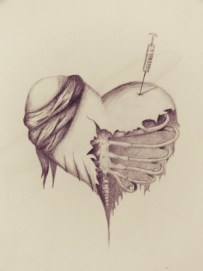 675x900 recovery drawing - Recovery Drawings