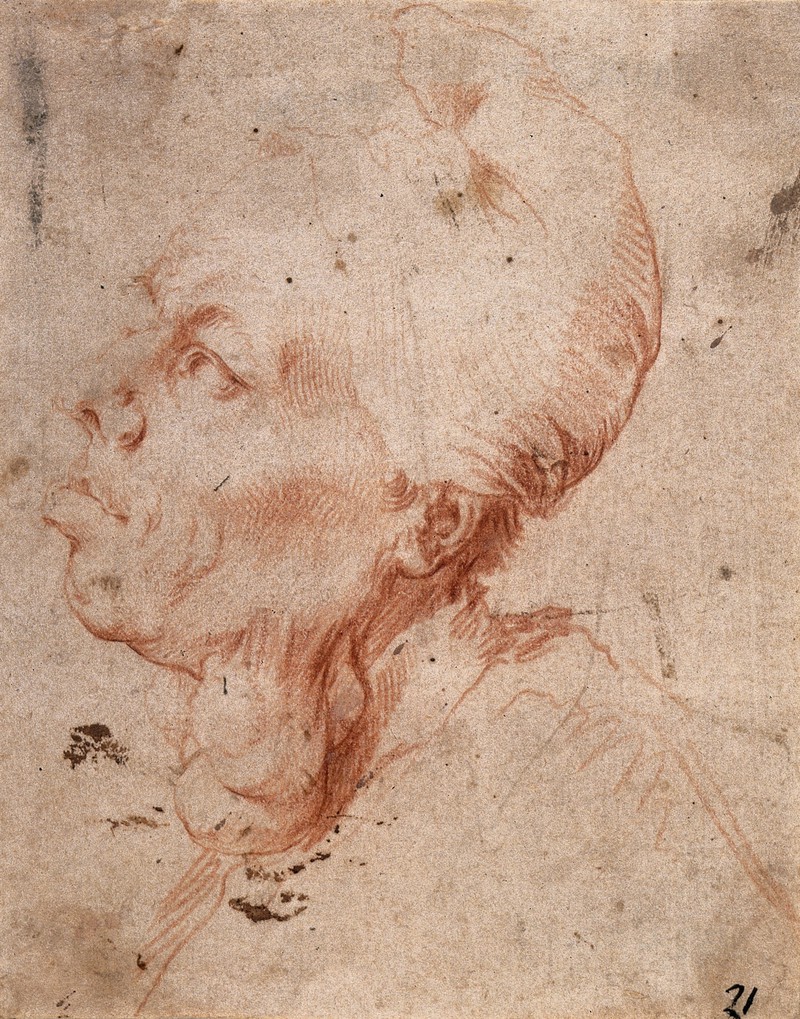 800x1019 a man with goitre red chalk drawing - Red Chalk Drawing