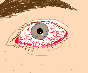 300x250 Tired, Red Eyes Drawing - Red Eye Drawing