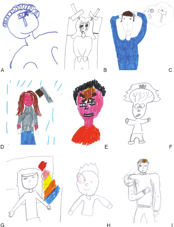 684x889 The Representative Drawings Of Migraine - Representative Drawing