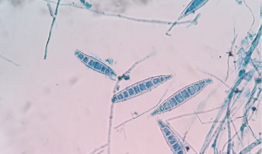 1088x640 Ringworm In Dogs Petcoach - Ringworm Drawing