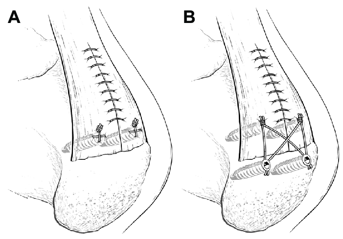 701x489 schematic line drawing - Row Drawing
