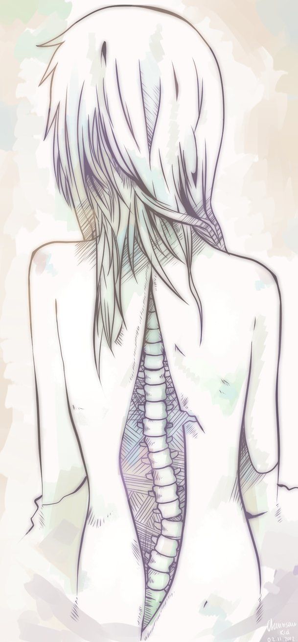 609x1310 my scoliosis story - Scoliosis Drawing
