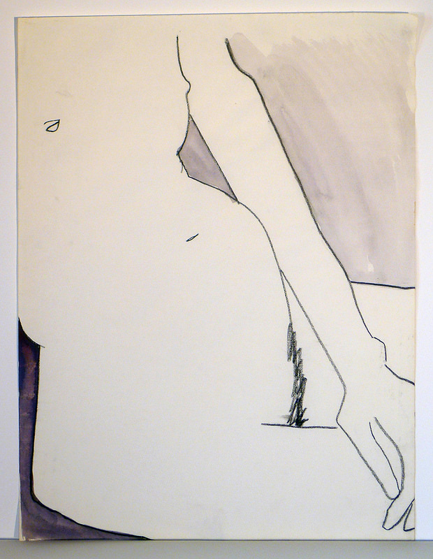 620x800 scoliosis i drawings - Scoliosis Drawing